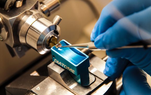 national-cancer-institute-K8AzGcMJbLI-unsplash JKUAT to offer Biomedical Engineering Course